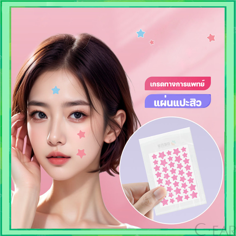 แผ่นแปะสิว แผ่นแปะรักษาสิว แผ่นสิว แผ่นแปะดูดสิว แผ่นดูดสิว แผ่นสติกเกอร์แปะสิว Acne Patches รูปดาวน่ารัก หลากสีสัน