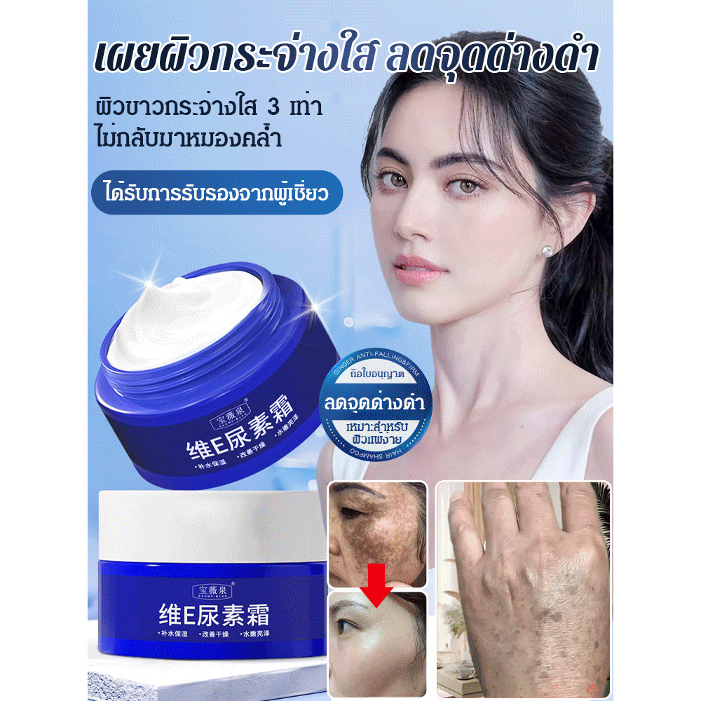 Hot Sell ซ วิตามินอี ครีมยูเรียลดจุดด่างดำ/ลดจุดด่างอายุและรอยแผลเป็น/สัมผัสครีมไวท์เทนนิ่งเฉพาะจุด แก้ฝ้า กระ จุดด่างดำ