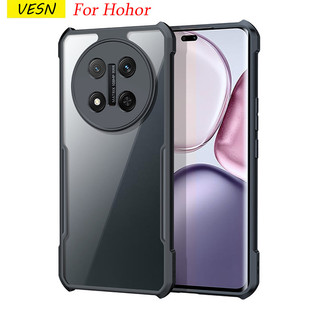 เลนส์กล้องหุ้มเกราะอะคริลิคใสป้องกันกรณีโทรศัพท์สำหรับ Honor Magic 7 6 400 200 90 Lite 20 8s X60 Pro X9 X9B X9C X8 X8A X8B X8C X7 X7A X7B X7C X6 X6A X6B X5 X5B 4G 5G 2025
