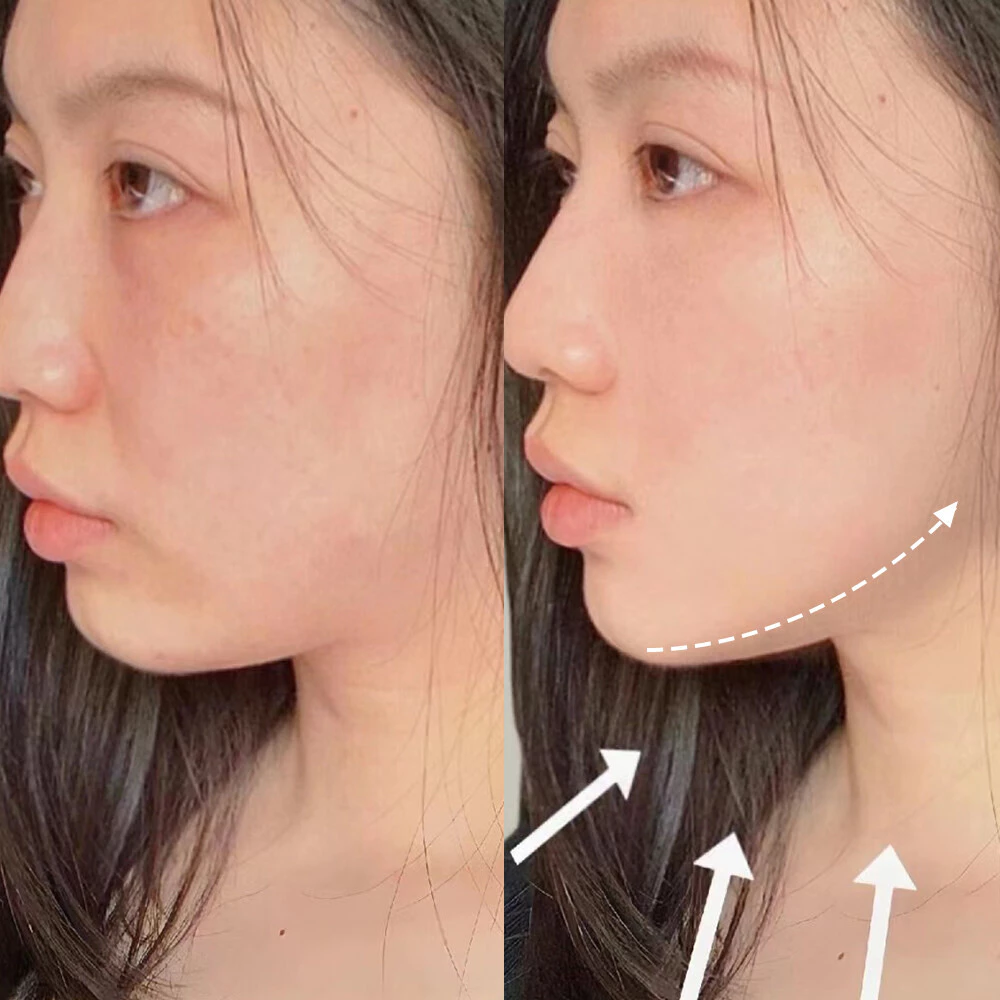COZII สายรัดกระชับหน้า V Shape thumbnail 4