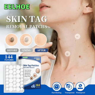 EELHOE Stiker Penghilang Kutil Tahi Lalat Wart Removal Patch 144 PCS