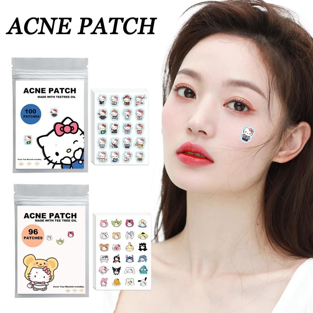 น่ารัก Hello Kitty Acne Patch สติ๊กเกอร์ดูแลผิวแมวการ์ตูน Pe Acne Stickers