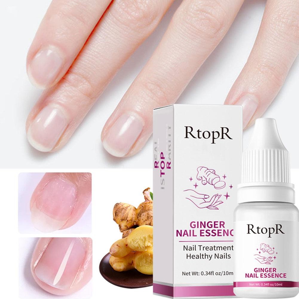 Rtopr Ginger Nail Essence Anti Infection Paronychia Treatment Nail E3P0