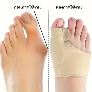 Featured อุปกรณ์แก้ไขนิ้วเท้า คอร์เร็คเตอร์ การดูแลเท้า เพื่อแก้ไขนิ้วเท้าผิดรูป