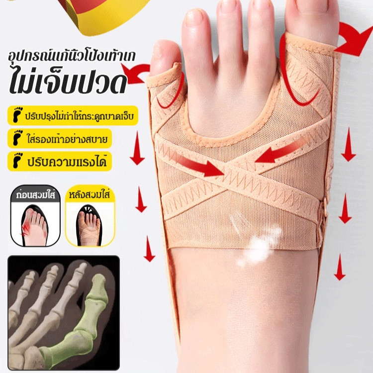 อุปกรณ์แก้นิ้วโป้งเท้าเก ระบายอากาศดี วัสดุยืดหยุ่นสูง สวมใส่สบาย ชุดแก้ไขเท้าผิดรูป รองรับนิ้วหัวแม่มือ