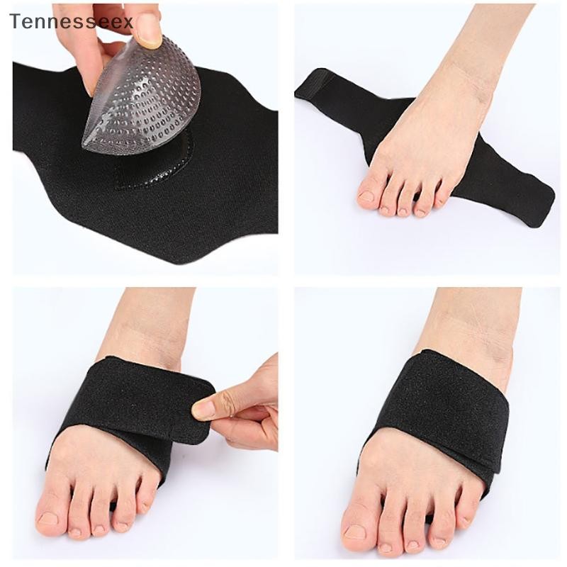 [TESN] เท้าแบน Arch สนับสนุนศัลยกรรมกระดูก Insoles Pads สําหรับรองเท้าผู้ชายผู้หญิงเท้า Valgus Varus กีฬา Insoles รองเท้าแทรกเบาะ OOQ