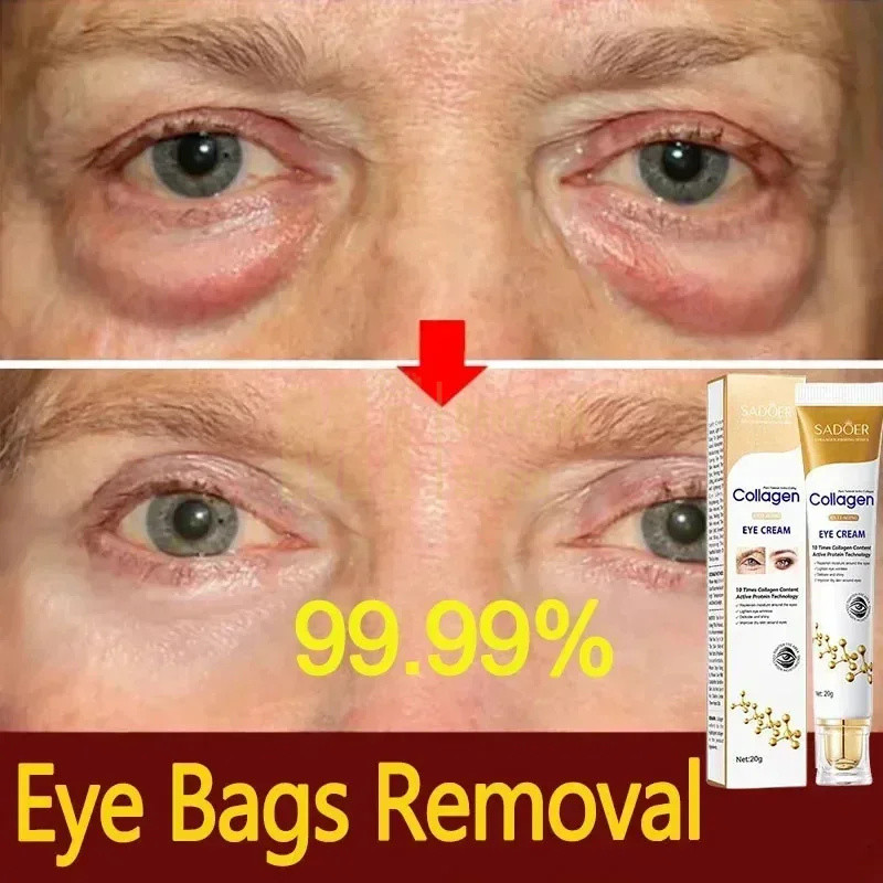 Collagen Eye Cream Anti-Wrinkle Eye BAG removal Fade Fine Lines Firming Skin Anti Dark Circle puffiness Eye Care