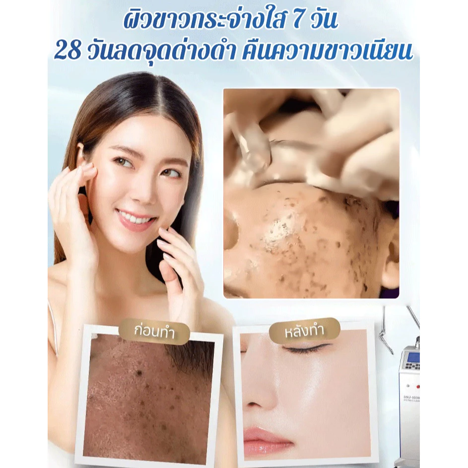🔥MY HOT🔥【จุดด่างดำและจุดเหลืองหายไป】ครีมลดเลือนจุดด่างดำ Urea 淡斑尿素霜70g วิตามินอีบำรุงผิวให้ความชุ่มชื้นและปรับผิวกระจ่างใส/ครีมบำรุงผิวลดเลือนริ้วรอย/ครีมวิตามินอีไวท์เทนนิ่งปรับผิวกระจ่างใส thumbnail 4