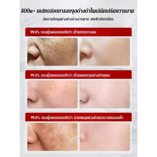 🔥1แถม1🔥ครีม 377 ลดริ้วรอยและจุดด่างดํา บํารุงผิวชุ่มชื้น เรียบเนียน ลดรอยสิว เหมาะสําหรับทุกสภาพผิว ครีมทาหน้า ครีมบํารุงผิว