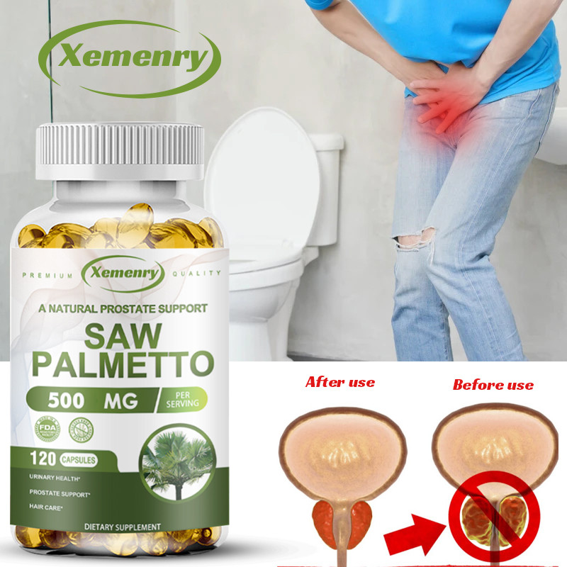 XEMENRY Saw Palmetto Capsules, การสนับสนุนสุขภาพต่อมลูกหมากและปัสสาวะ, บล็อก DHT ธรรมชาติ, การป้องกันการสูญเสียเส้นผม