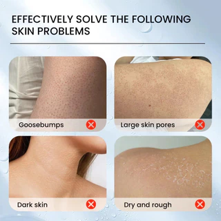 Keratosis Pilaris Repair cream Bumpy Rough Chicken Follicle Skin Repair Strawberry Legs Removal Dry Skin Care