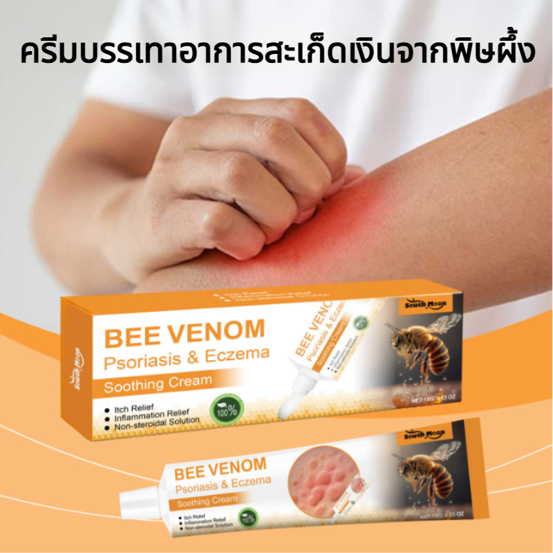 เบลิ 1 ฟรี 1 ครีมรักษาโรคสะเก็ดเงินพิษผึ้ง บรรเทาอาการคันและไม่สบายผิว รักษาโรคสะเก็ดเงินและ