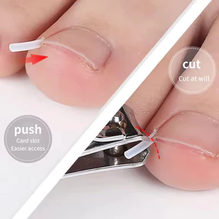 10/20/30 ชิ้นคุด Toenail Corrector - แผ่นรองหลอดรูปตัว C ยืดหยุ่น - รักษาเล็บนิ้วเท้า คลิปยืดร่องที่มองไม่เห็น