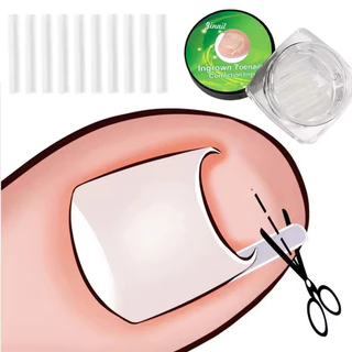 10/20/30 ชิ้นคุด Toenail Corrector - แผ่นรองหลอดรูปตัว C ยืดหยุ่น - รักษาเล็บนิ้วเท้า คลิปยืดร่องที่มองไม่เห็น