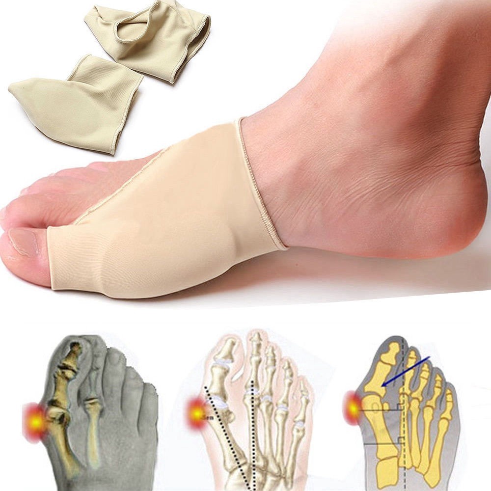 ตัวป้องกันแขนตาปลาแบบยืดหยุ่นป้องกันการบาดเจ็บ Hallux Valgus