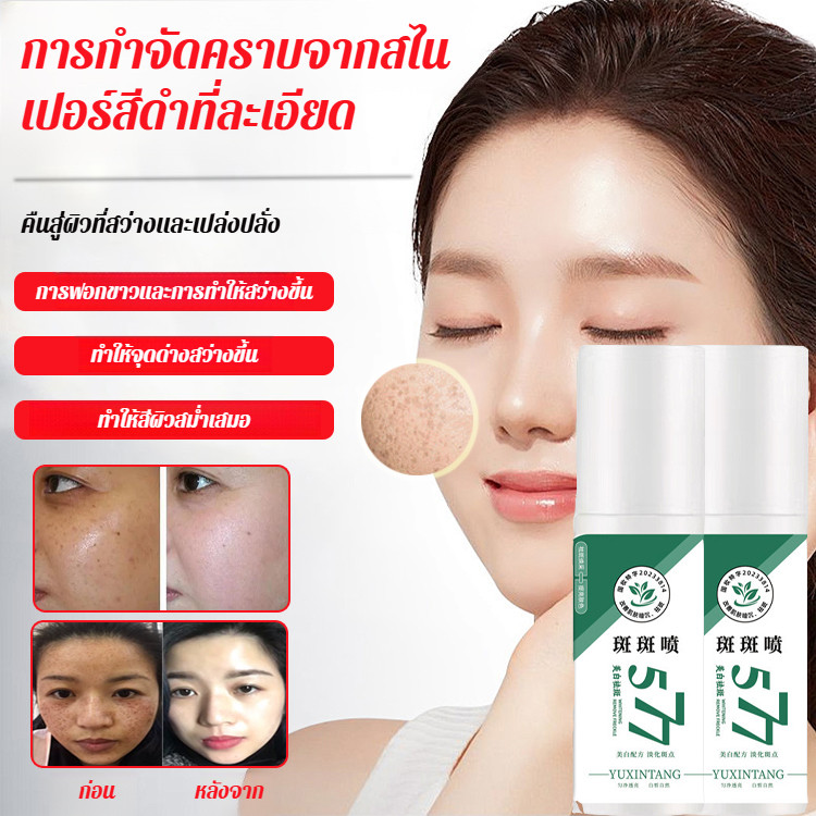 ✅เซรั่ม 577 ลดจุดด่างดำ✅ เห็นผล7วัน✨วิตามินซี+กรดไฮยาลูโรนิค✨ให้ความชุ่มชื้น+กระชับรูขุมขน✨สำหรับฝ้า