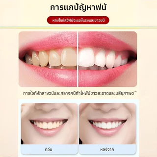 ยาสีฟันโปรไบโอติก SP-10 ลดคราบเหลืองจากชา/กาแฟ ปราศจาก SLS ลดกลิ่นปาก