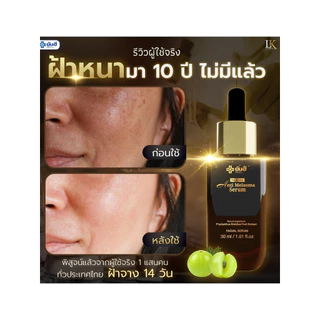 เซรั่มลดฝ้า ยันฮี [ของแท้ 100% รับประกัน] Yanhee Anti Melasma Serum ลดฝ้า กระ จุดด่างดำ 1 ขวด