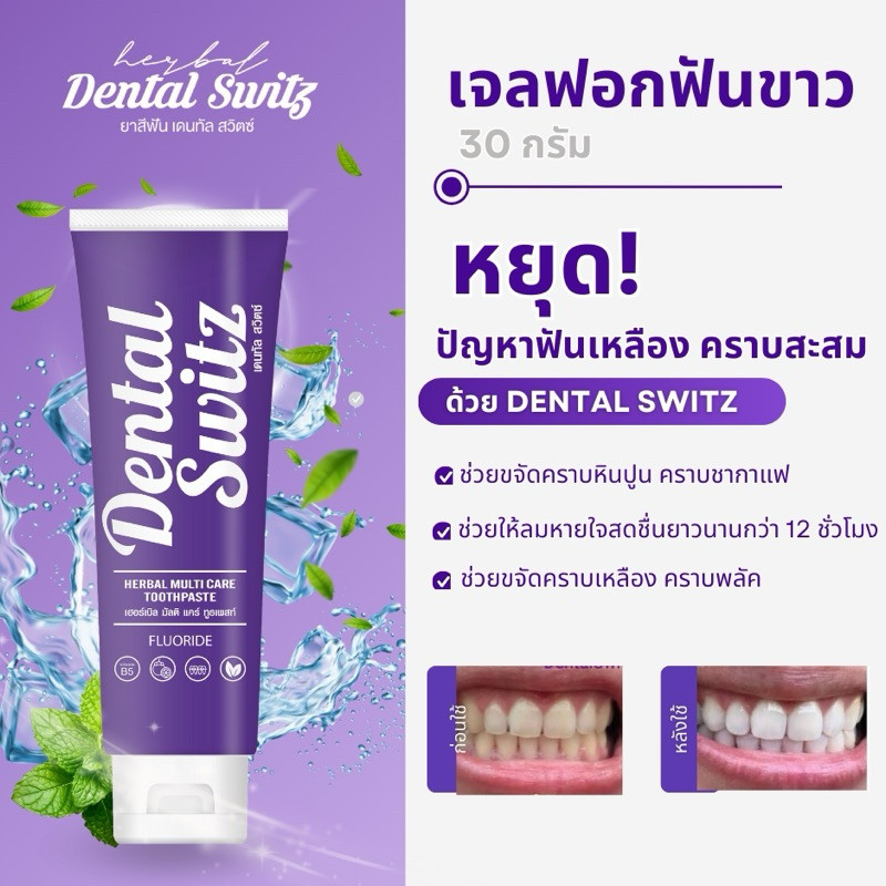 [เจลฟอกฟันขาว+รางฟอก] Dental Switz เดนทัลสวิตซ์ ฟอกฟันแปรงฟัน ปากสะอาด กลิ่นปาก หินปูน ฟันเหลืองจาก ชากาแฟ บุหรี่