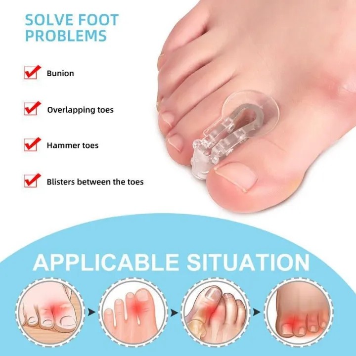 1 คู่ Toe Corrector Splints Bunion Corrector Toe Separator Overlap Separator Bunion Finger Corrector