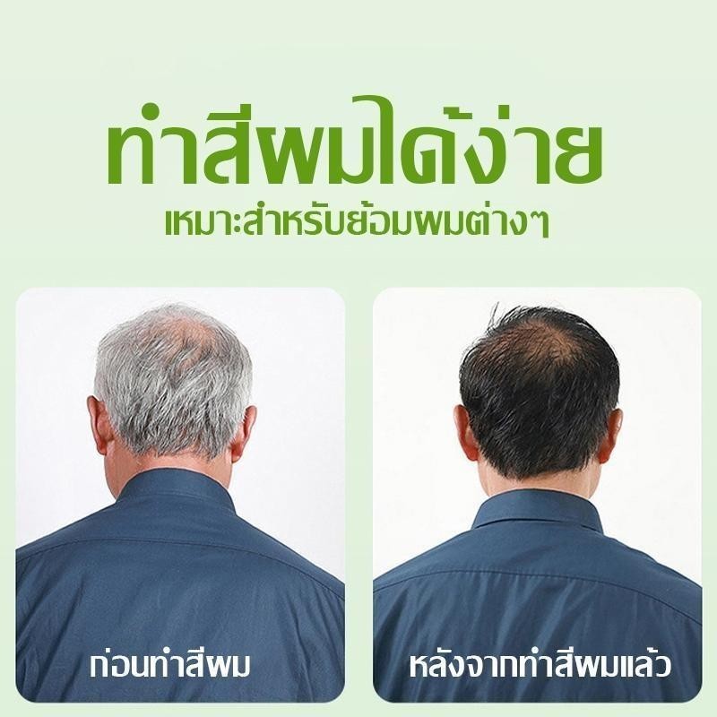[10แถม10] สีย้อมผม สีธรรมชาติ ไม่ต้องผสมสี อ่อนโยนและไม่ระคายเคือง โฟมย้อมผมยอดนิยมแพค 30มล. มี 4 สีให้เลือก รูปที่ 5