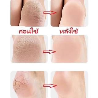 ซิลิโคนรองส้นเท้า ถนอมส้นเท้า แก้ปวดส้นเท้า ซิลิโคนถนอมส้นเท้า ส้นเท้าแตกของแท้ รองช้ำ แพ็คคู่ Silicone Heels Cover