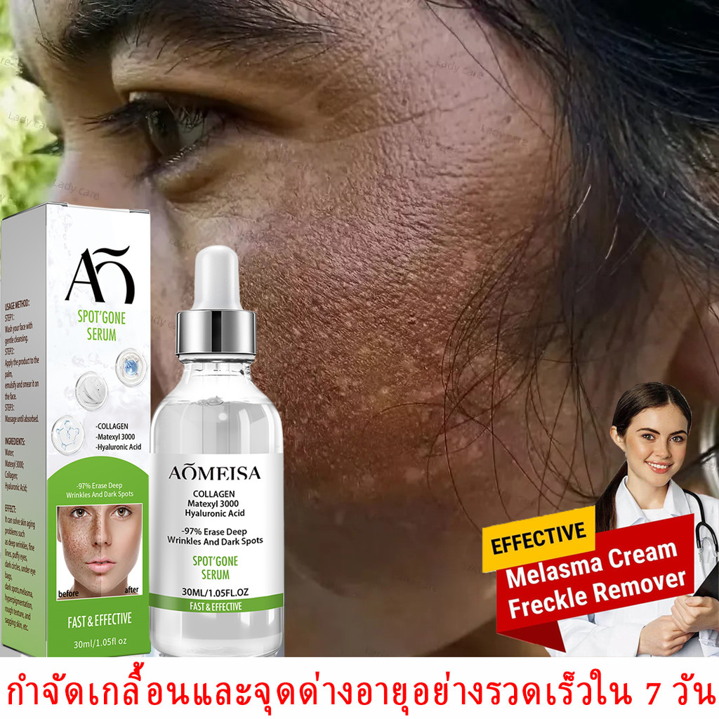 เอสเซ้นต่อต้านกระ, ไวท์เทนนิ่งและลดน้ำหนัก, ลบจุดเมลานิน, กระ, จุดด่างอายุ, จุดด่างดำ, เอสเซ้นไวท์เทนนิ่ง, ครีมให้ความชุ่มชื้น, ผลิตภัณฑ์ดูแลผิว