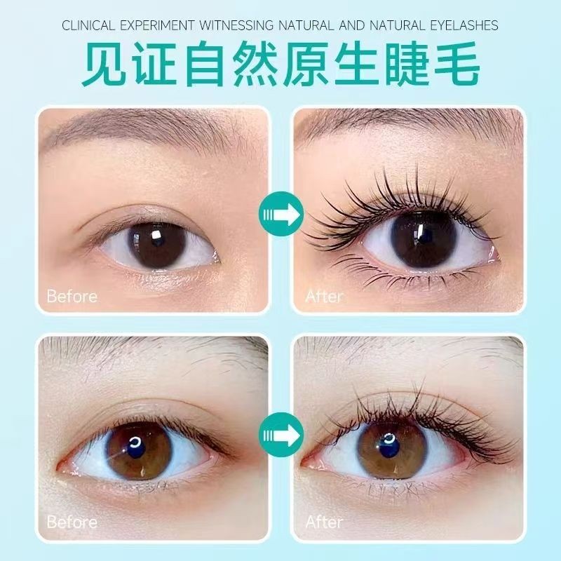 อินเดีย Careprost Careprost Eyelash Growth Nutrient Liquid Eyebrow หนาธรรมชาติ Fast Growth Brushless ราคา ถูกที่สุด ดีลบีเคเค แกลเลอรีภาพที่ 4