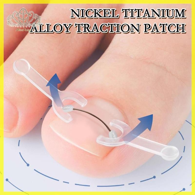 คุดเล็บเท้าแก้ไขเครื่องมือคุด Toe Nail Treatment Elastic Patch สติกเกอร์ Straightening คลิปรั้ง Pedicure เครื่องมือ TH