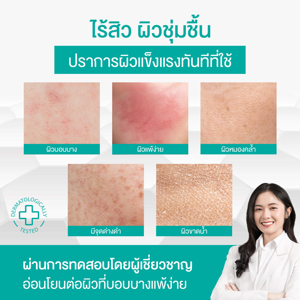 Smooth E Babyface Foam 1.2 Oz. สมูทอี เบบี้เฟส โฟม pH5 ลดสิวผิวแข็งแรง สำหรับคนผิวมัน เป็นสิว - 5