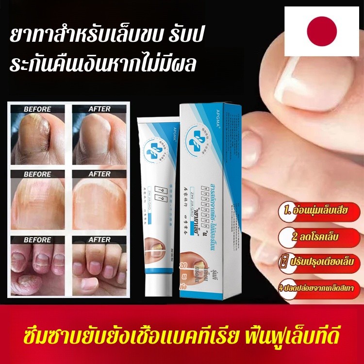 แท้ % ป้องกันการ เกิดซ้ํา สีเทา ยาทาเล็บ ครีมดูแล ยาทาเล็บสีเทา