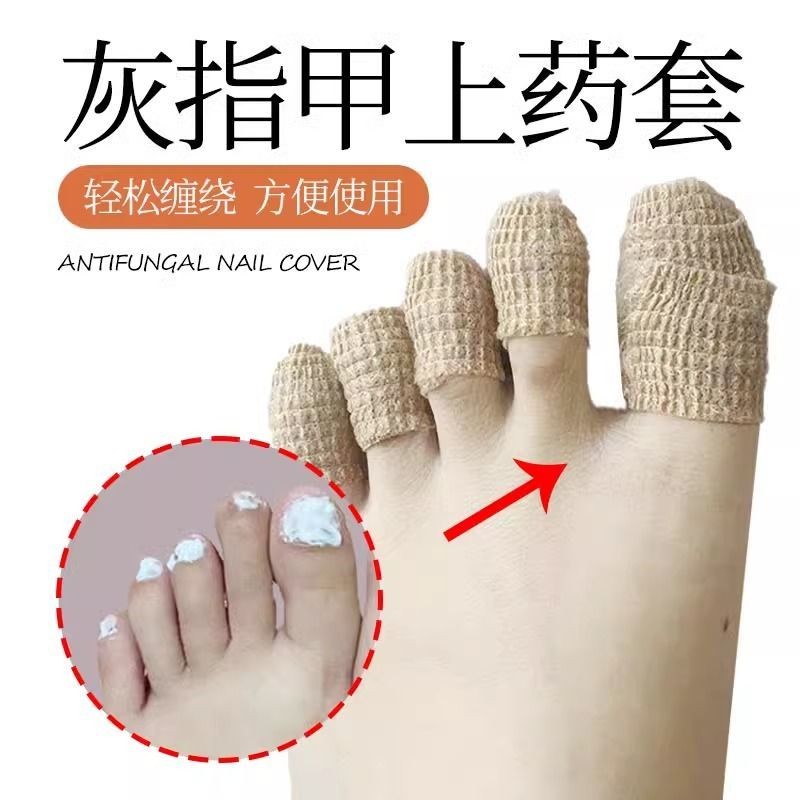Onychomycosis ฝาครอบป้องกัน Toe Medicine ฝาครอบป้องกัน ฝาครอบป้องกัน Toe Onychomycosis ยา Toe-ww24 V