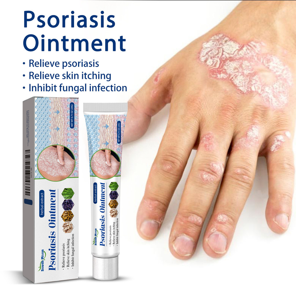 ครีมป้องกันเชื้อราสําหรับ Jock Itch: Anti Fungal Cream สําหรับอาการคันผิวหนังบรรเทาความแข็งแรงเป็นพิ