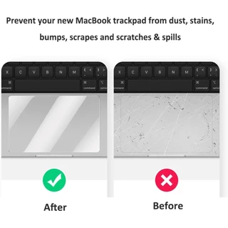 Matte TrackPadฟิล์มอุปกรณ์เสริมสําหรับMacbook Neo 13 A3404 Air 13.6/15.3 M4 M3 M2 A3240 A2681 A2941 Anti Scratch cover Pro 13 14 15 16 นิ้วแล็ปท็อปสติกเกอร์ผิว