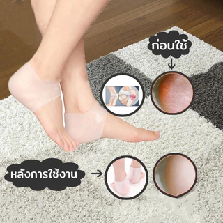ซิลิโคนรองส้นเท้า ถนอมส้นเท้า แก้ปวดส้นเท้า ซิลิโคนถนอมส้นเท้า ส้นเท้าแตกของแท้ รองช้ำ แพ็คคู่ Silicone Heels Cover