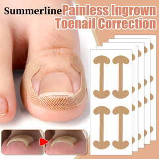 รักษาเล็บเท้าไม่เจ็บปวดฝังเล็บ-แก้ไขเล็บเท้าระบายอากาศกันน้ํ…