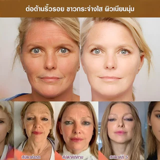 เซรั่ม ทองคำบริสุทธิ์ ฟื้นฟูผิว ของเหลวเดิม เอสเซนส์ ผิว น้ําตบ ต่อต้านวัย เซรั่มไฮยา 24k gold serum