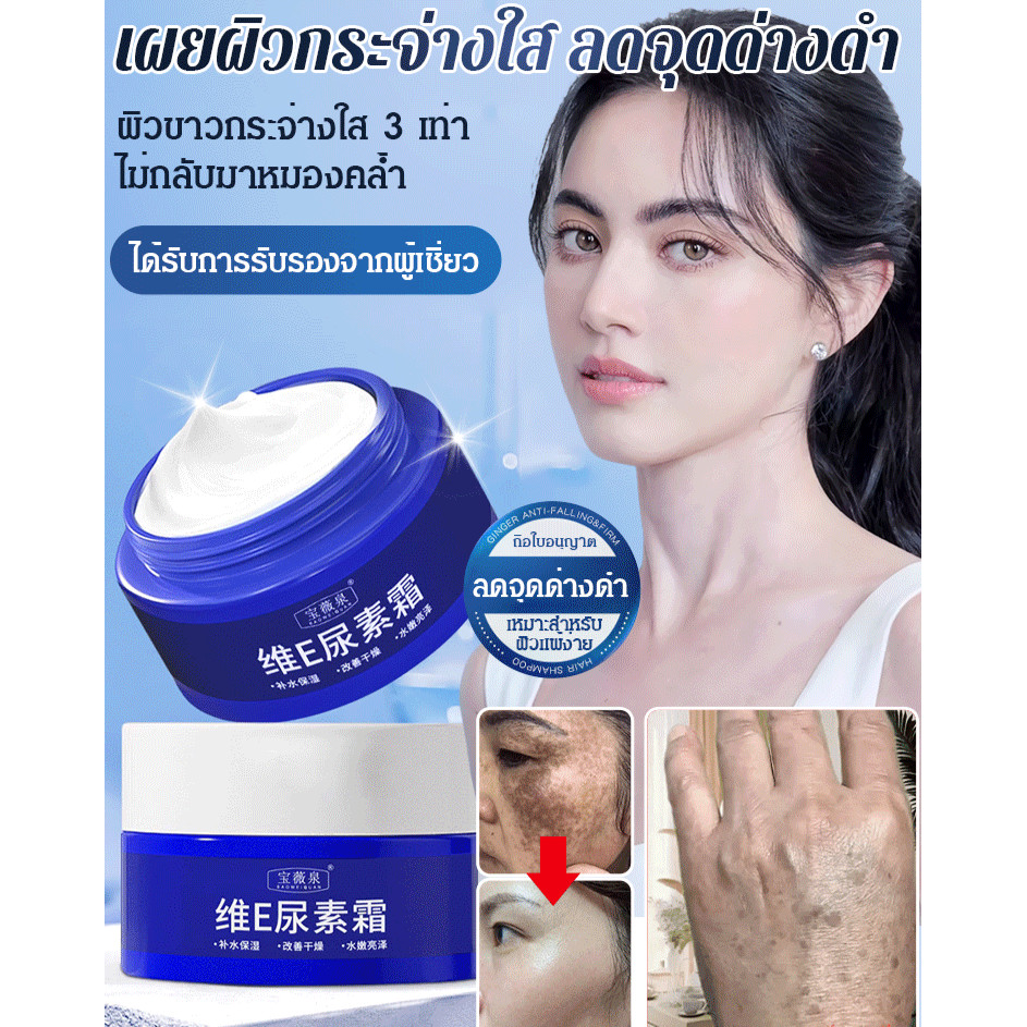 Urea cream for old spots, yellow spots, urea cream for whitening and freckles