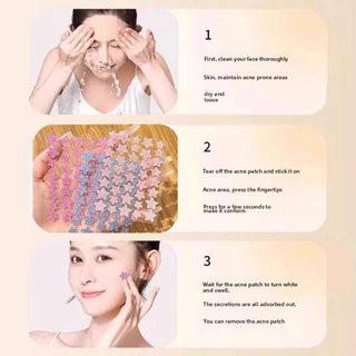 40 ชิ้น Glitter Star Acne Patch Hydrocolloid Skin Care สิวสิวแพทช์