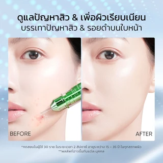 SKINTIFIC 3X ACID INTENSIVE ACNE SPOT ดูแลสิวอย่างตรงจุดใน 3 วัน บรรเทารอยแผลเป็นจากสิว