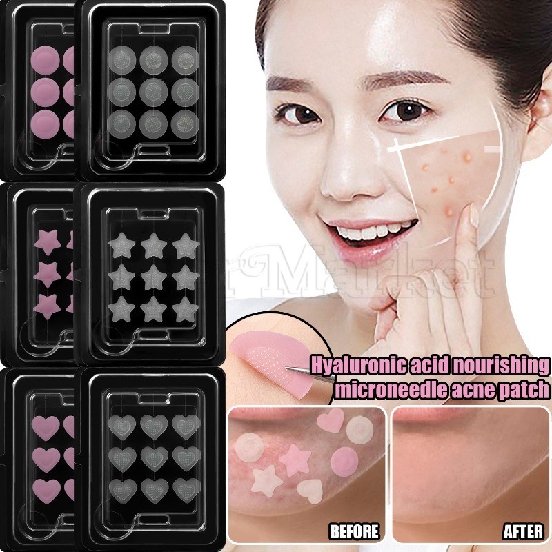 [ แนะนํา] สติ๊กเกอร์สิว Pink Star Heart - แผ่นแปะจุดใบหน้าระบายอากาศ - Mini Removal Pimple Paster - คอนซีลเลอร์สิวกันน้ํา - อุปกรณ์ดูแลผิว - เครื่องมือรักษาสิวความงาม