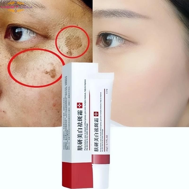 Dark Spot Remover ครีมจุดด่างดํา Melasma Freckle Corrector ครีมสําหรับทุกสภาพผิว Dark Spot Corrector