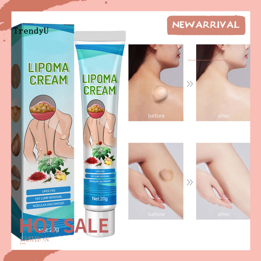 TRD 20g Fatty Lump Cream ไม่เจ็บปวดไม่ปิดกั้นการเจาะอย่างต่อเนื่อง Resolve Subcutativeal Lump-Free Lipoma Removal ครีมสําหรับร่างกาย