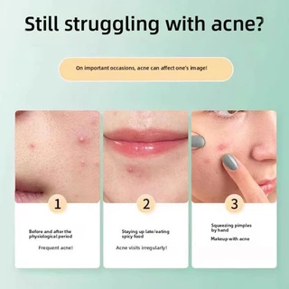 40 ชิ้น Glitter Star Acne Patch Hydrocolloid Skin Care สิวสิวแพทช์