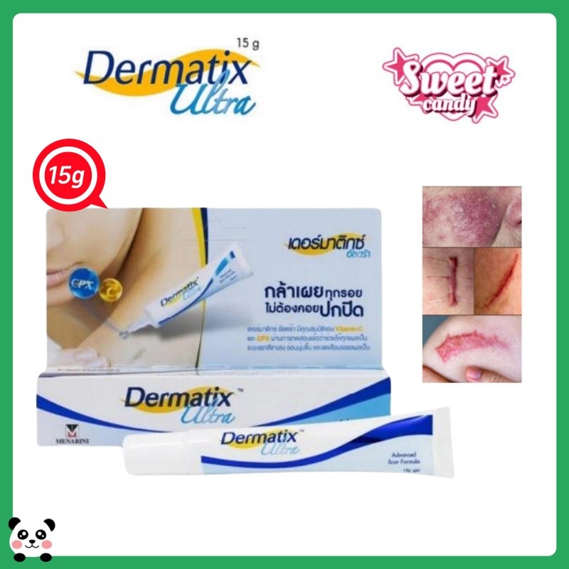 DERMATIX แท้ 100% ผิวหนัง พิเศษ เจล 15ก ครีมลดรอยแผลเป็น ครีมรักษาแผลเป็น เจลแผลเป็น เจลลดรอยแผลเป็น แผลเป็นคีลอยด์ แผลเป็นนูน