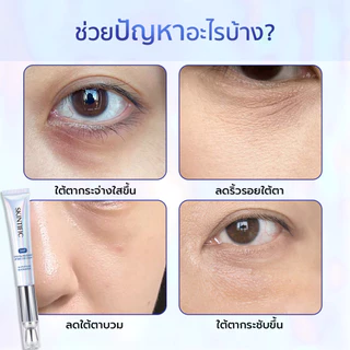 SKINTIFIC 360 อายครีมพร้อมเครื่องนวดคริสตัล ครีมยกกระชับรอบดวงตา Lifting Eye Cream บำรุงผิวใต้ตา อายครีม