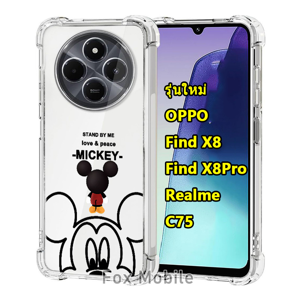 Case For Find X8 Pro เคสลายการ์ตูน น่ารัก สำหรับ OPPO Find X8 / X8Pro Pro For Realme C75 พร้อมส่ง เคสกันกระแทก 029 TP