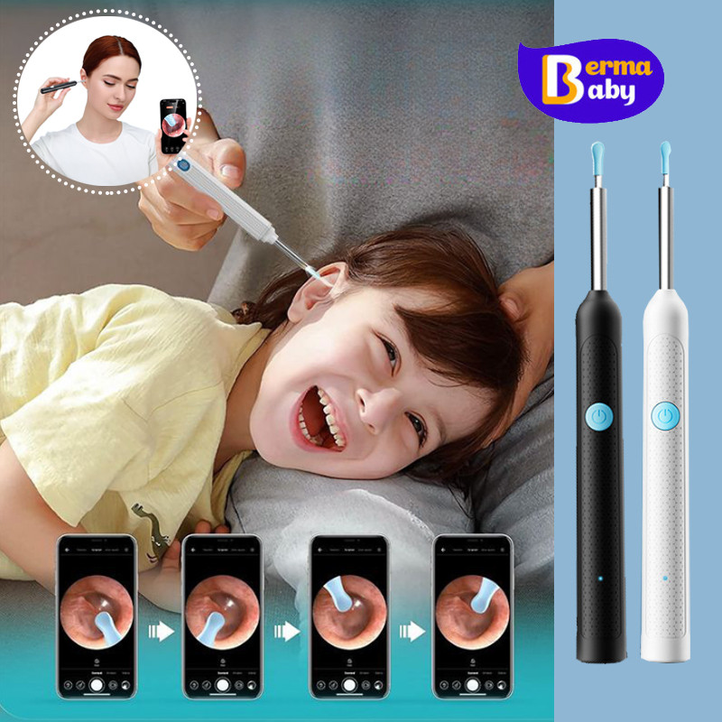 Berma Baby แคะหูพร้อมกล้อง HD พิกเซล 2000W ซิลิโคนนุ่ม พร้อมไฟ ทําความสะอาดหู สําหรับเด็กทารก