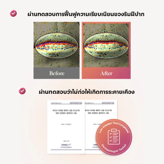 UIQ Biome Barrier Melting Moisture Lip Balm ลิปบาล์ม ปากนุ่ม ชุ่มชื้น 4 เฉดสี สกินแคร์เกาหลี