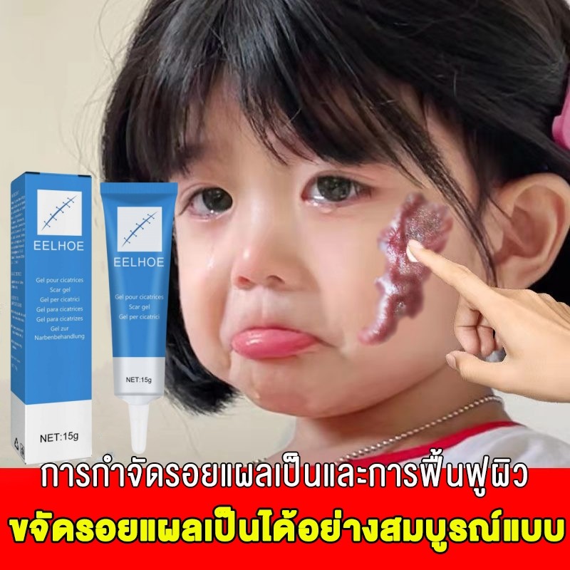 ครีมลบรอยแผลเป็น ครีมซ่อมแซมรอยแผลเป็นบนใบหน้าและร่างกาย เจลซ่อมแซมรอยแผลเป็นทั้งรอยแผลเป็นเก่าและใหม่ 15g